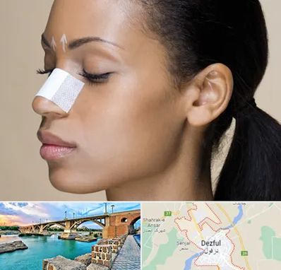 دکتر جراح بینی خانم در دزفول