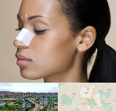 دکتر جراح بینی خانم در شهریار