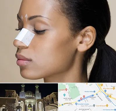 دکتر جراح بینی خانم در زرگری شیراز 