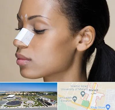 دکتر جراح بینی خانم در ملارد