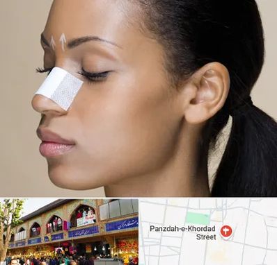 دکتر جراح بینی خانم در 15 خرداد