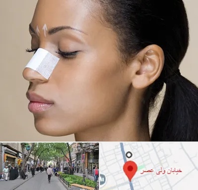 دکتر جراح بینی خانم در ولیعصر شهریار