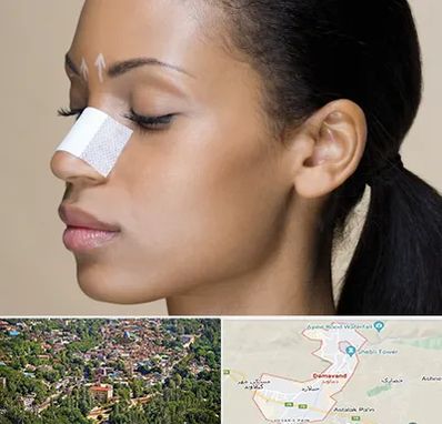 دکتر جراح بینی خانم در دماوند