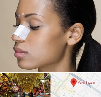 دکتر جراح بینی خانم در بازار وکیل شیراز