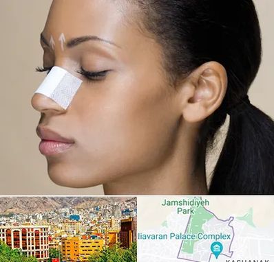 دکتر جراح بینی خانم در نیاوران 