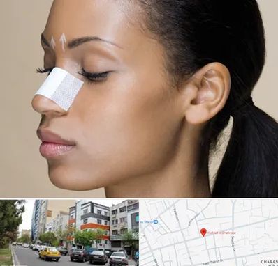 دکتر جراح بینی خانم در هفده شهریور تبریز