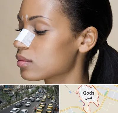 دکتر جراح بینی خانم در شهر قدس