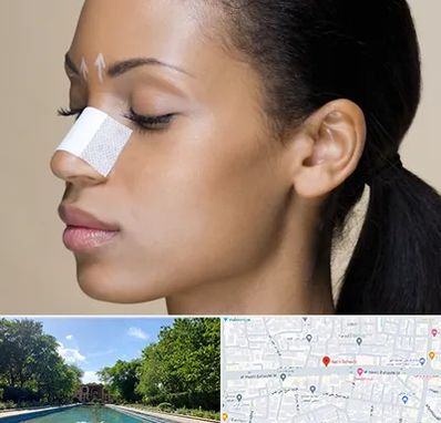 دکتر جراح بینی خانم در هشت بهشت اصفهان 