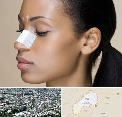 دکتر جراح بینی خانم در شاهرود