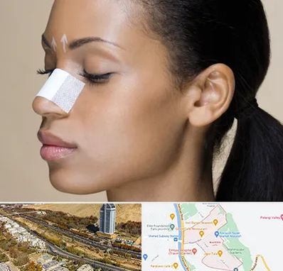 دکتر جراح بینی خانم در خیابان نیایش شیراز 