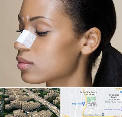 دکتر جراح بینی خانم در اکباتان 