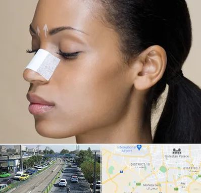 دکتر جراح بینی خانم در جنوب تهران 