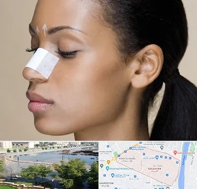 دکتر جراح بینی خانم در گلستان اهواز 