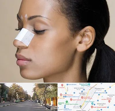 دکتر جراح بینی خانم در شریعتی 