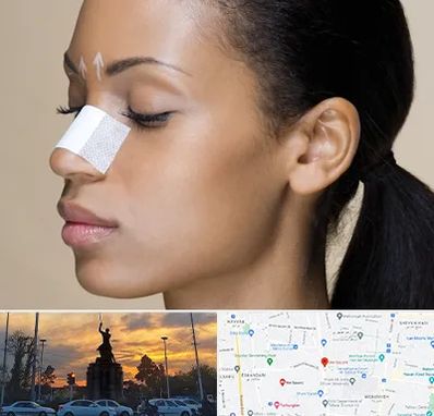 دکتر جراح بینی خانم در میدان حر 