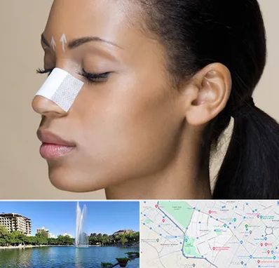 دکتر جراح بینی خانم در کوهسنگی مشهد 