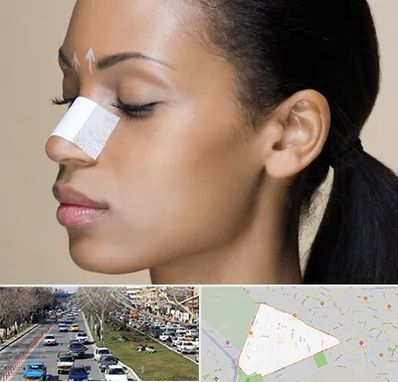 دکتر جراح بینی خانم در احمدآباد مشهد 