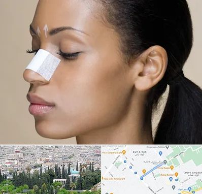 دکتر جراح بینی خانم در محلاتی شیراز 