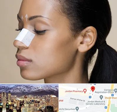 دکتر جراح بینی خانم در جردن 