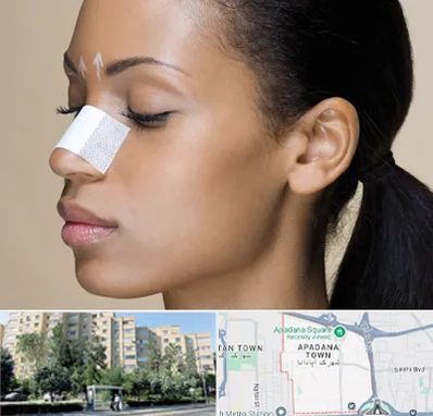 دکتر جراح بینی خانم در آپادانا