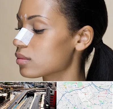 دکتر جراح بینی خانم در ستارخان شیراز 