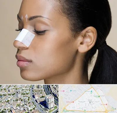 دکتر جراح بینی خانم در قاسم آباد مشهد 