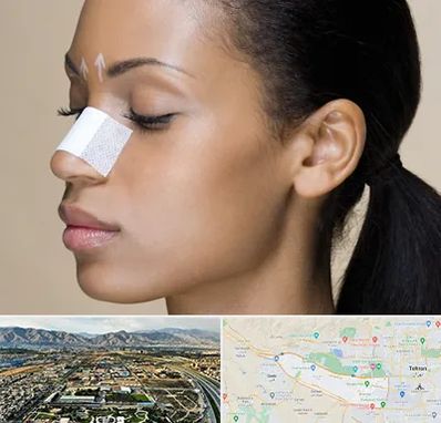 دکتر جراح بینی خانم در منطقه 21 تهران 