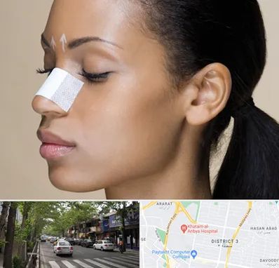 دکتر جراح بینی خانم در ظفر 