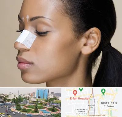 دکتر جراح بینی خانم در ونک 