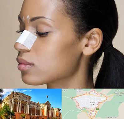 دکتر جراح بینی خانم در خوی