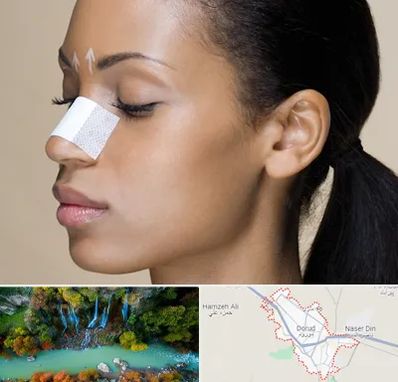 دکتر جراح بینی خانم در دورود