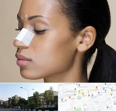 دکتر جراح بینی خانم در میدان کاج 