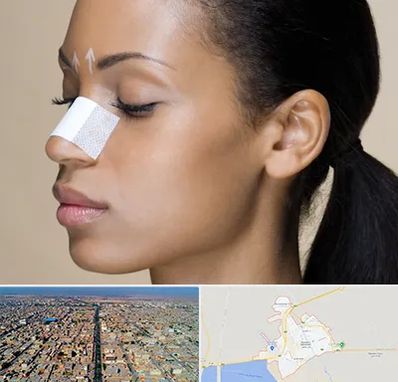 دکتر جراح بینی خانم در بندر ماهشهر