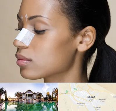 دکتر جراح بینی خانم در شیراز