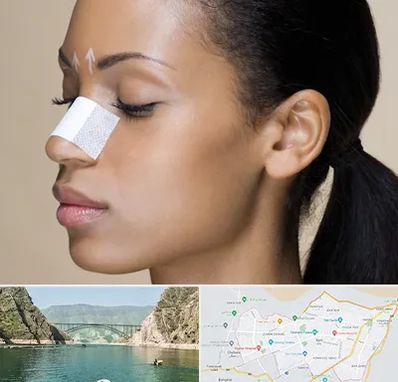 دکتر جراح بینی خانم در ایلام