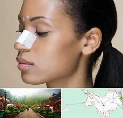 دکتر جراح بینی خانم در فومن
