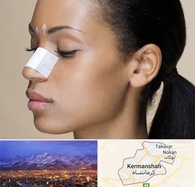 دکتر جراح بینی خانم در کرمانشاه