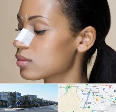 دکتر جراح بینی خانم در شریعتی مشهد 