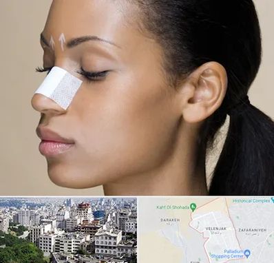 دکتر جراح بینی خانم در ولنجک 