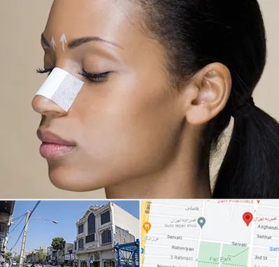 دکتر جراح بینی خانم در افسریه 