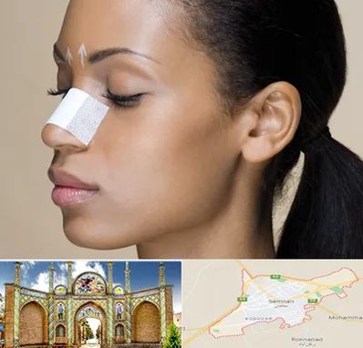 دکتر جراح بینی خانم در سمنان
