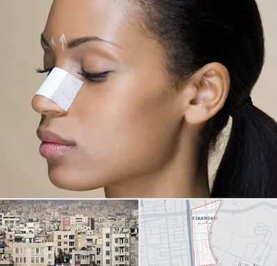 دکتر جراح بینی خانم در اسکندری