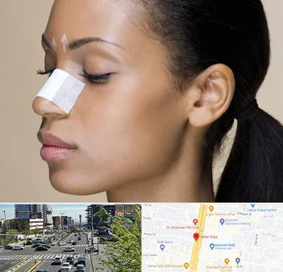 دکتر جراح بینی خانم در ستاری 