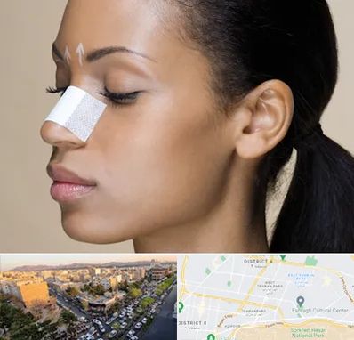 دکتر جراح بینی خانم در تهرانپارس 