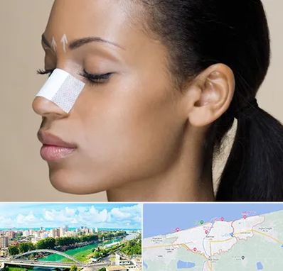 دکتر جراح بینی خانم در بابلسر