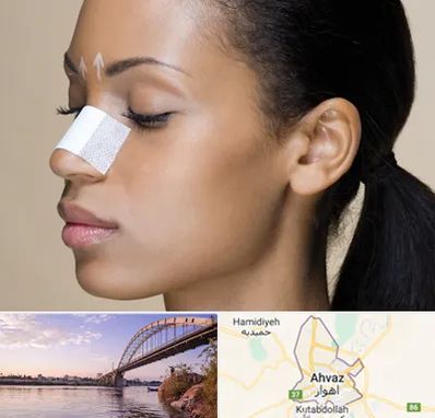 دکتر جراح بینی خانم در اهواز