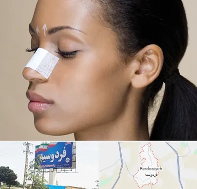 دکتر جراح بینی خانم در فردوسیه شهریار