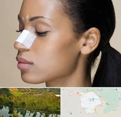 دکتر جراح بینی خانم در بهبهان