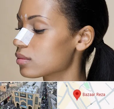 دکتر جراح بینی خانم در بازار رضا مشهد