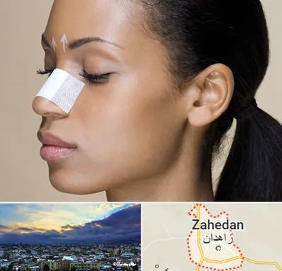 دکتر جراح بینی خانم در زاهدان